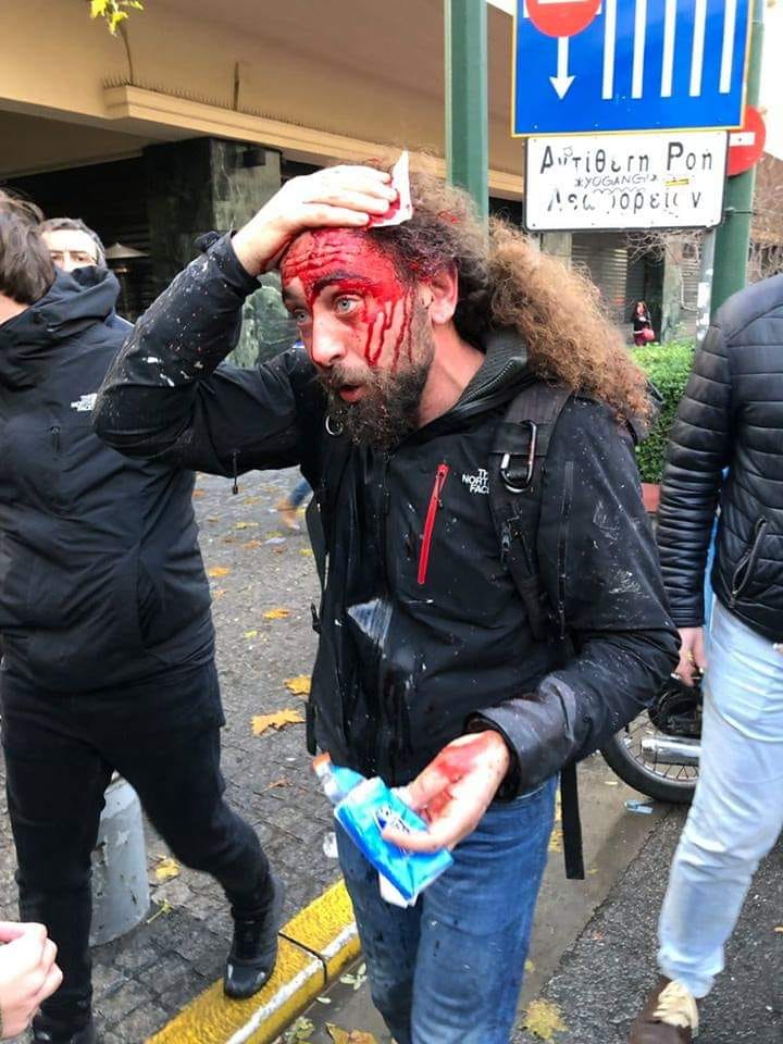 Φασιστικές επιθέσεις σε φωτορεπόρτερ και δημοσιογράφους κατά τη διάρκεια του «συλλαλητηρίου για τη Μακεδονία»