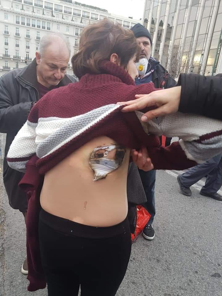 Εκπαιδευτικός τραυματίστηκε στο συλλαλητήριο της Αθήνας-Ένταση και χημικά