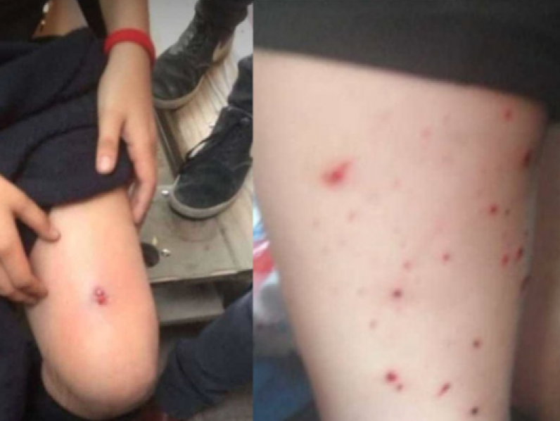 Χιλή: Καραμπινιέροι εισέβαλαν σε σχολείο και πυροβόλησαν μαθήτριες